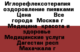 Иглорефлексотерапия, оздоровление пиявками › Цена ­ 3 000 - Все города, Москва г. Медицина, красота и здоровье » Медицинские услуги   . Дагестан респ.,Махачкала г.